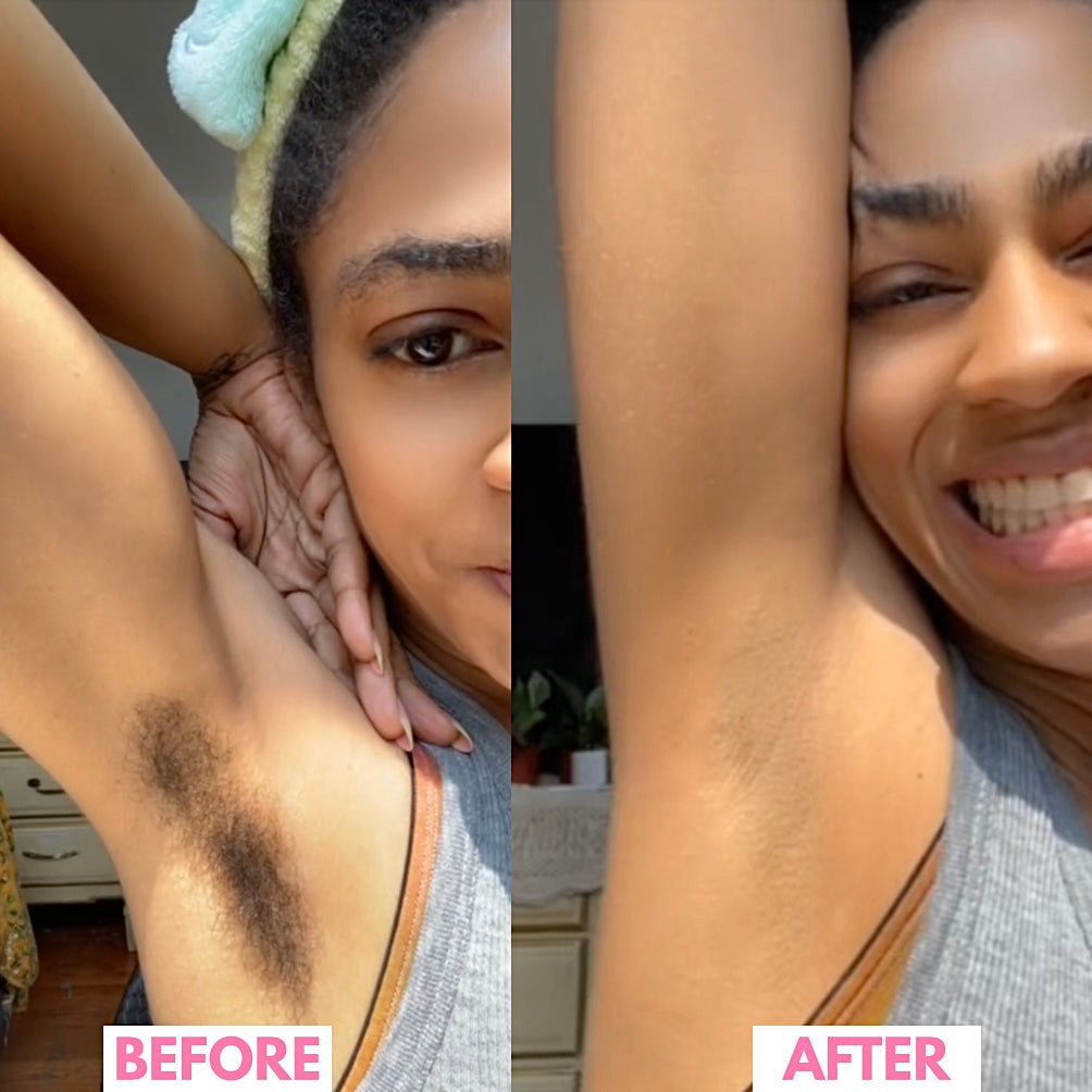 Body Hair Removal Mask